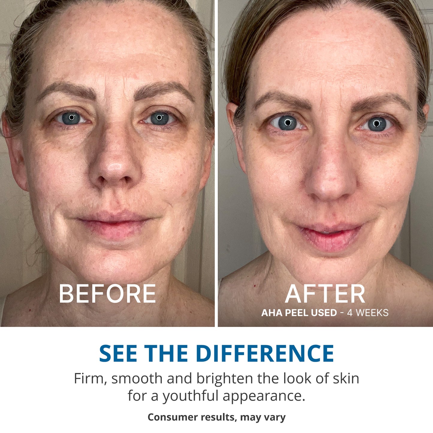 Wake Up Radiant AHA Peel