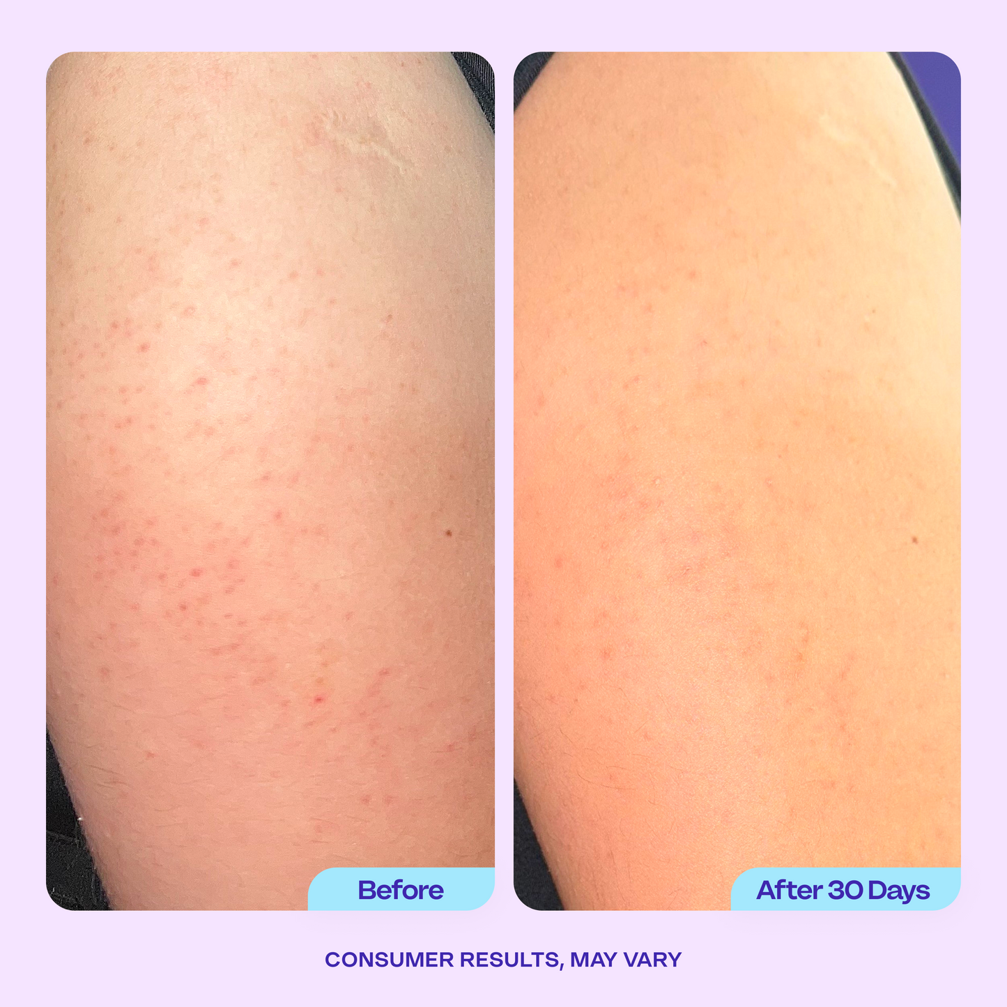 Refine & Renew Body Scrub