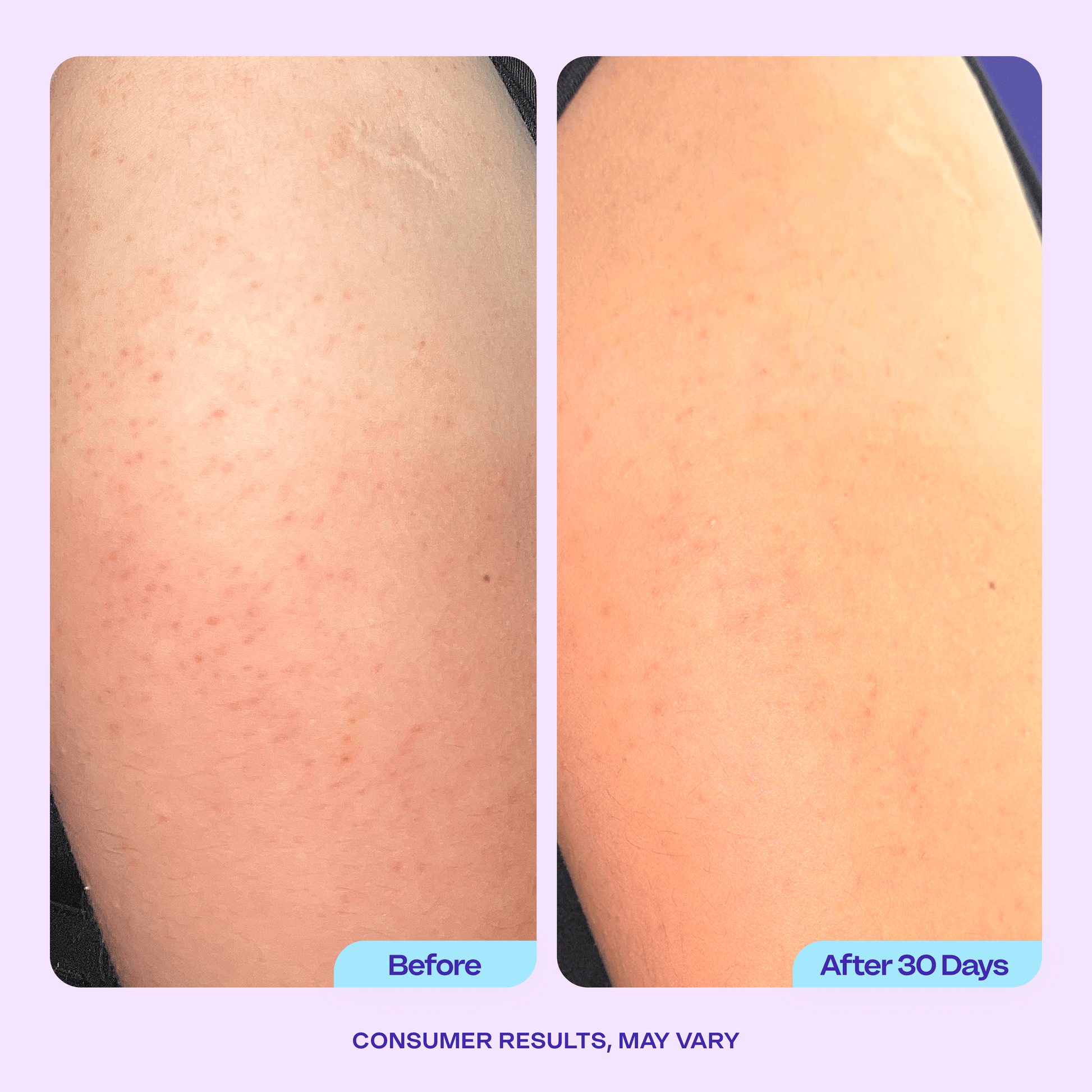 Before-and-after comparison of a person’s arm showing smoother, clearer skin after 30 days of using goPure Refine & Renew Body Scrub. Text reads “Consumer results, may vary.”