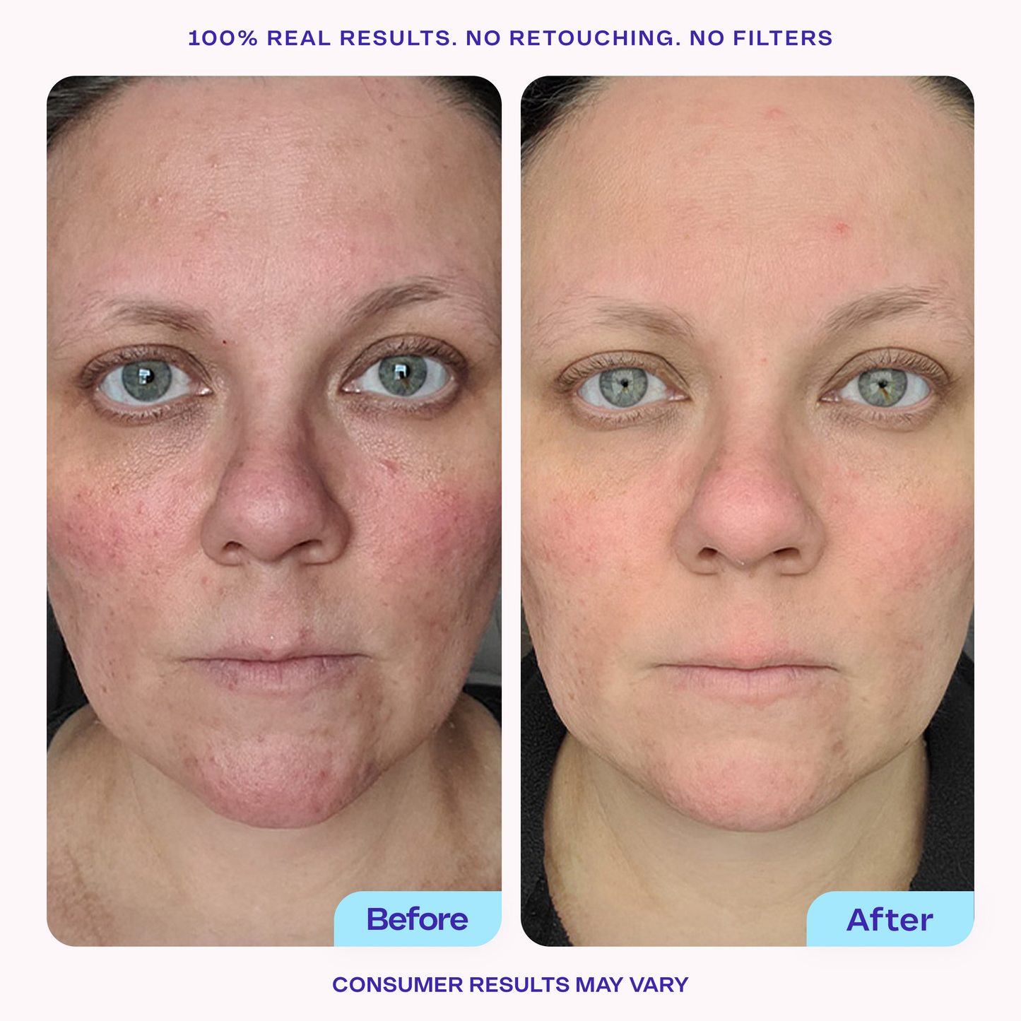 Brighten & Even Serum