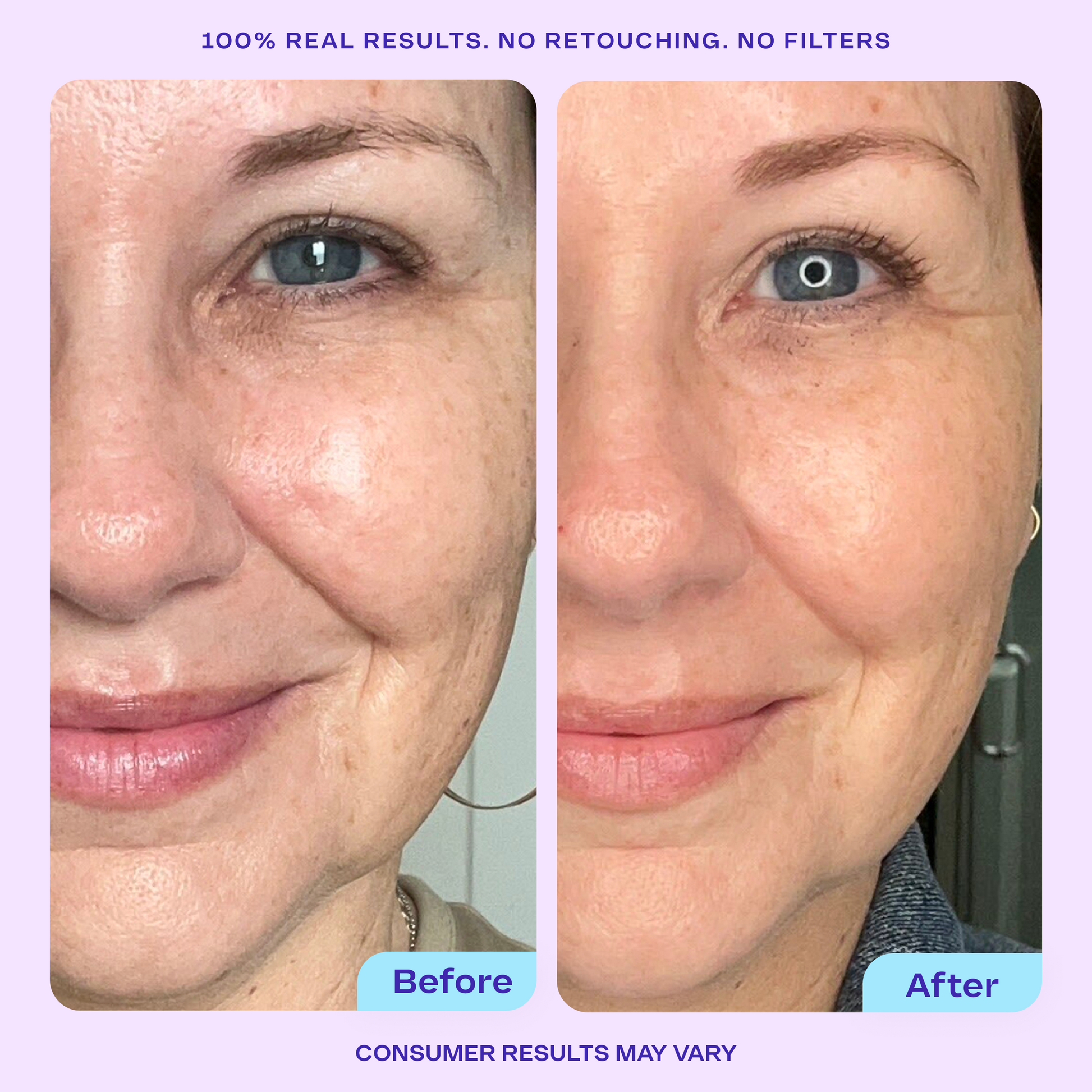 Side-by-side before and after comparison of a woman’s face showing visible skin improvement. The “Before” image shows fine lines and uneven skin tone, while the “After” image shows smoother, more radiant, and hydrated skin. Text above reads “100% real results. No retouching. No filters,” and below reads “Consumer results may vary.”