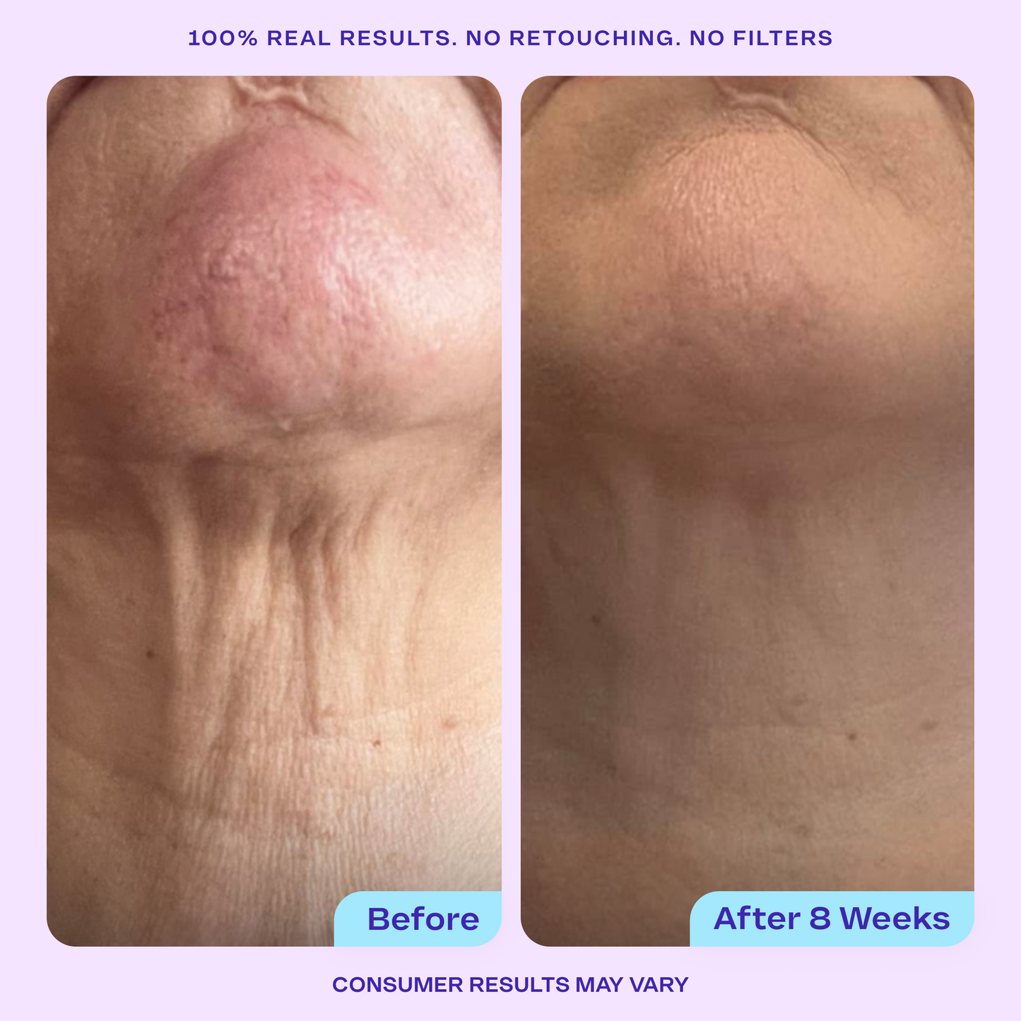 Sculpt & Lift Duo