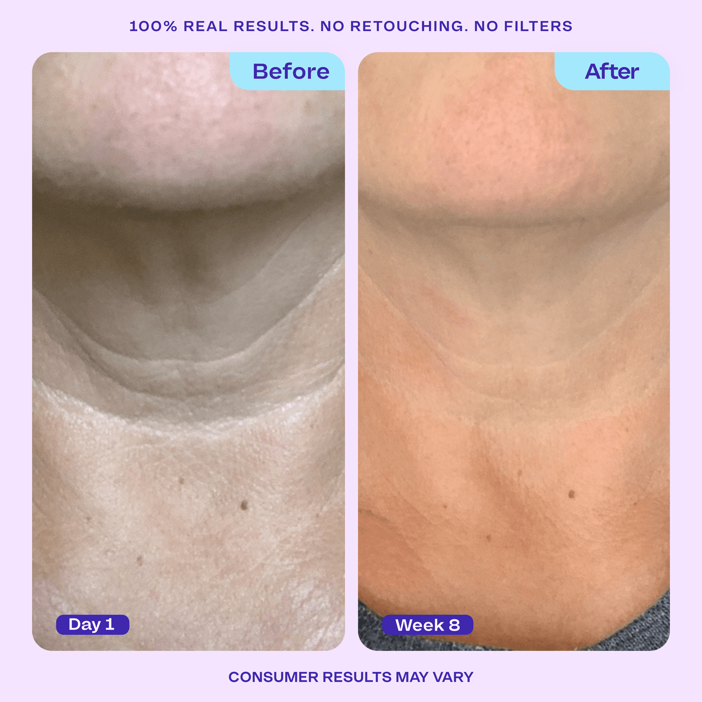 Arm Cream + Neck Cream