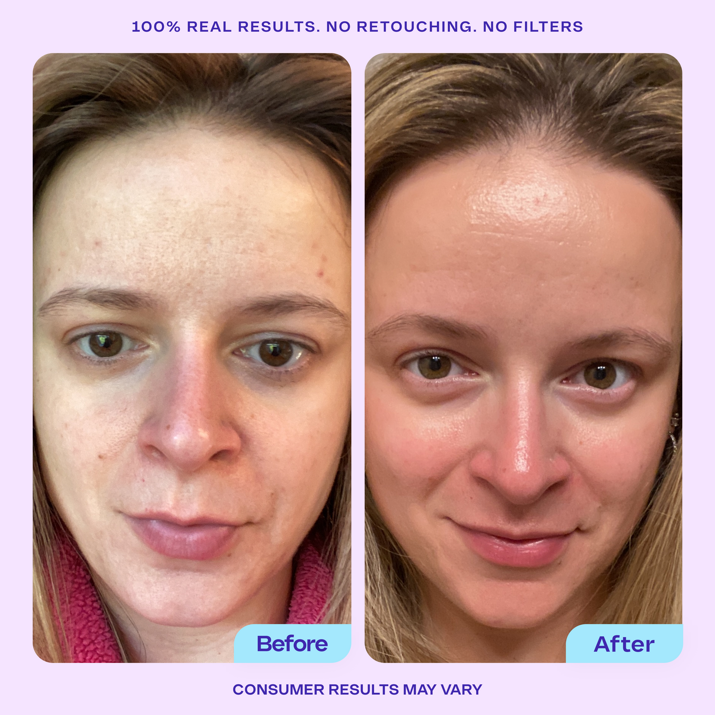 Niacinamide Booster Serum