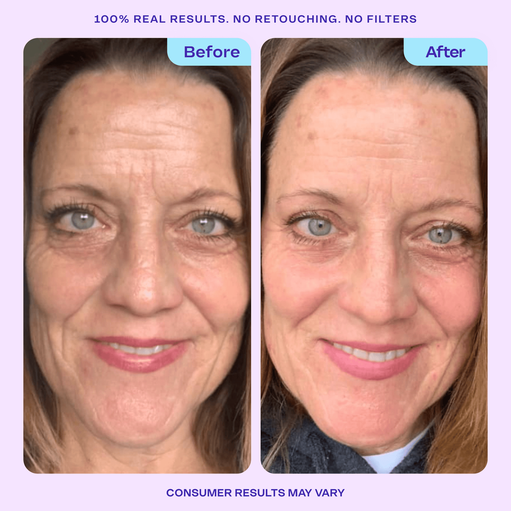 Side-by-side “Before” and “After” close-up photos of a woman’s face. The “Before” image shows visible wrinkles and uneven texture, while the “After” image shows smoother, more radiant skin with reduced lines. Text above reads: “100% Real Results. No Retouching. No Filters.” and below: “Consumer results may vary.”