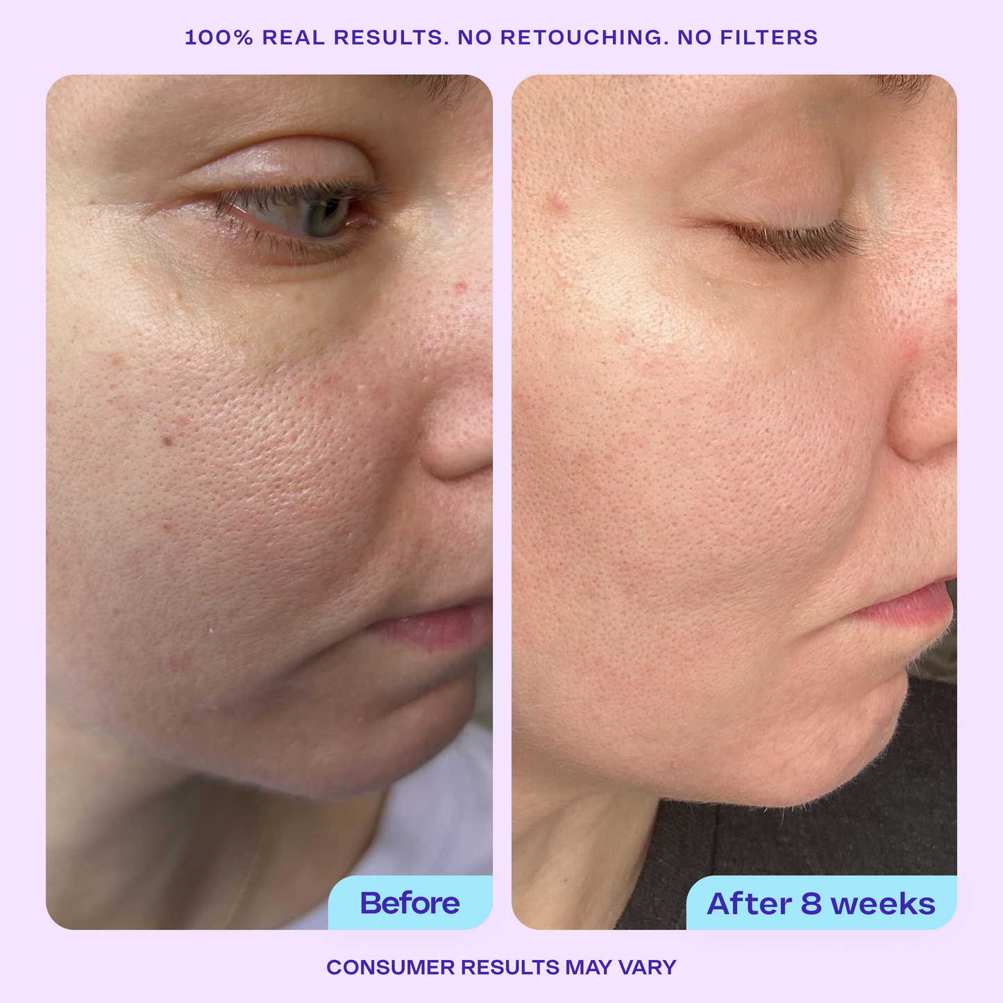 Refine It! BHA Liquid Exfoliant