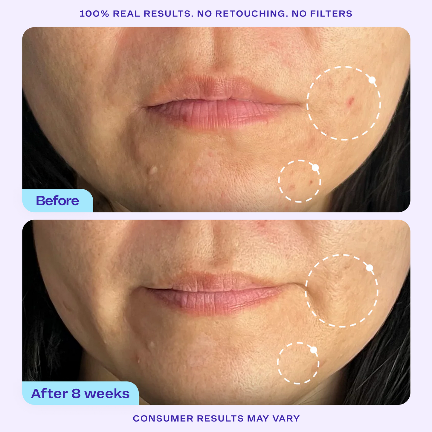 Refine It! BHA Liquid Exfoliant