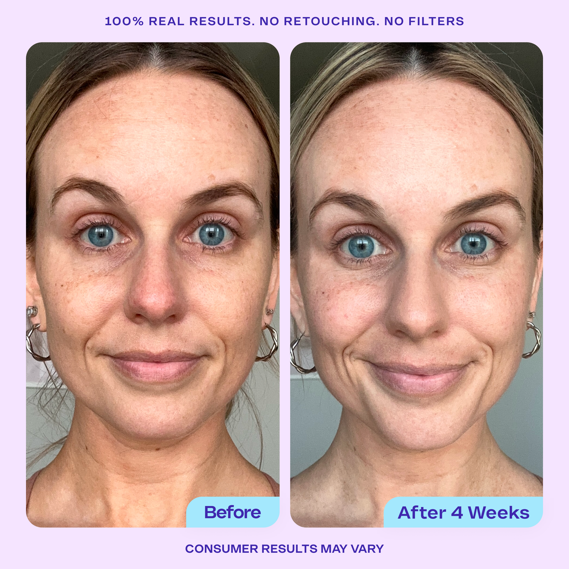 Side-by-side “Before” and “After 4 Weeks” comparison photos of a woman’s face showing visible improvement in brightness and evenness after using goPure Wake Up Radiant AHA Peel. The “Before” image shows mild redness and uneven tone, while the “After” image displays smoother, more radiant skin. Text reads: “100% real results. No retouching. No filters. Consumer results may vary.”