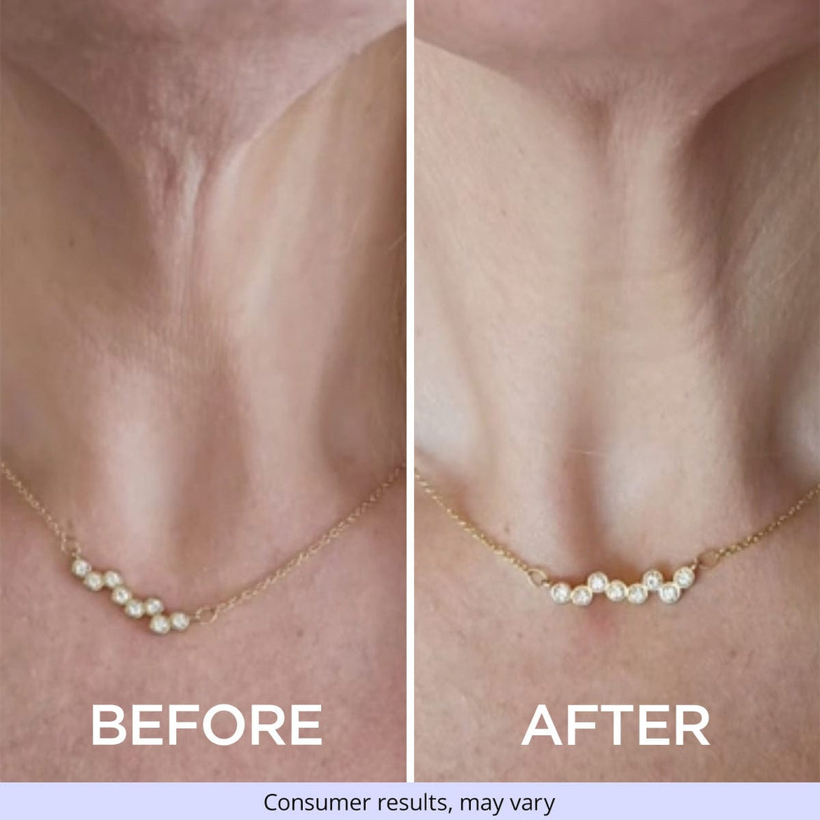 Side-by-side comparison of a woman's neck wearing a pearl necklace, showing "before" and "after" using GoPure Tighten & Lift Neck Cream. The "before" image shows looser skin, while the "after" image shows smoother, firmer skin. Text at the bottom reads, "Consumer results, may vary."