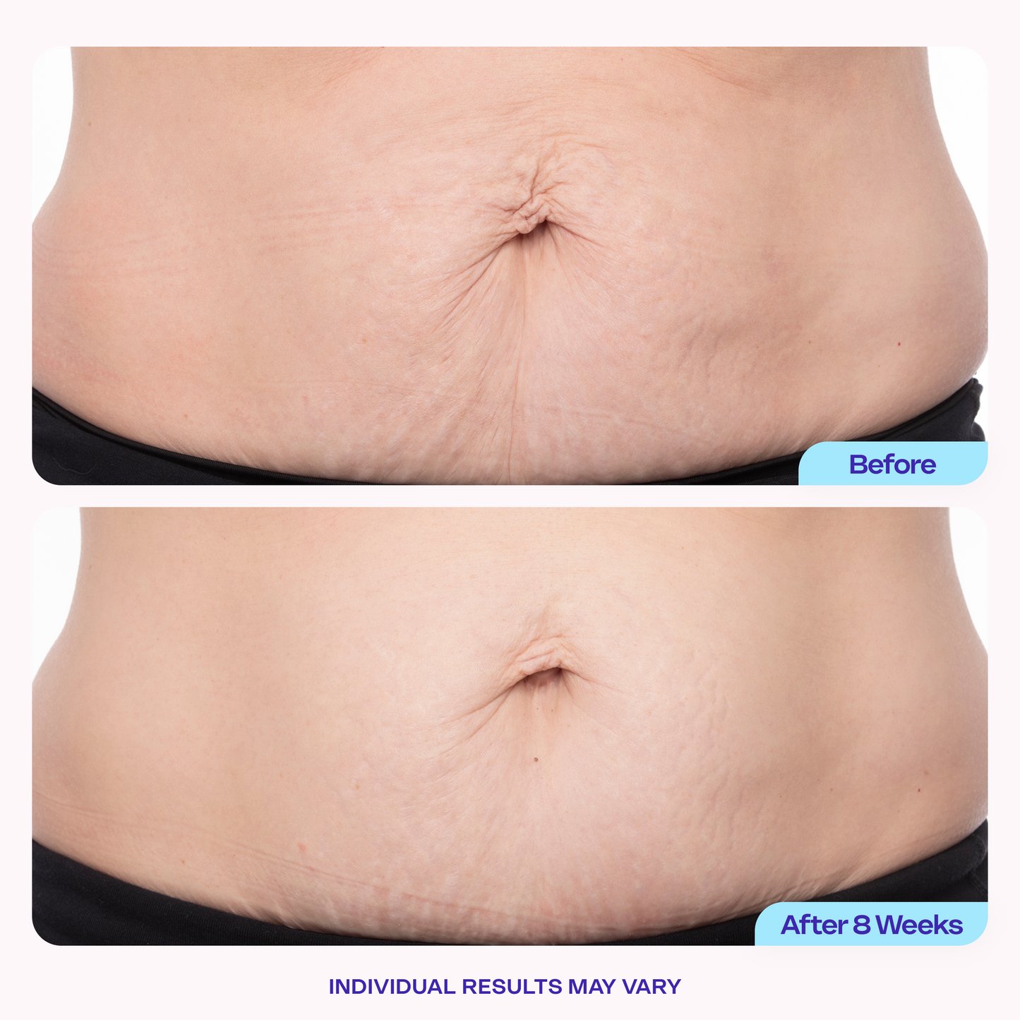 Body Confidence Set