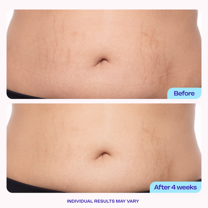Tighten & Smooth Belly Cream