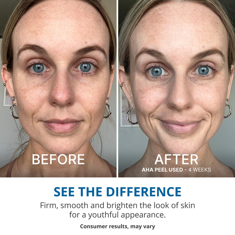 Wake Up Radiant AHA Peel