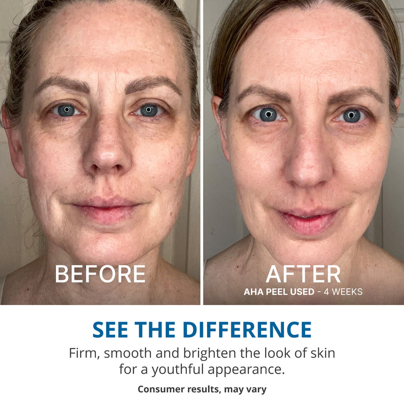 Wake Up Radiant AHA Peel