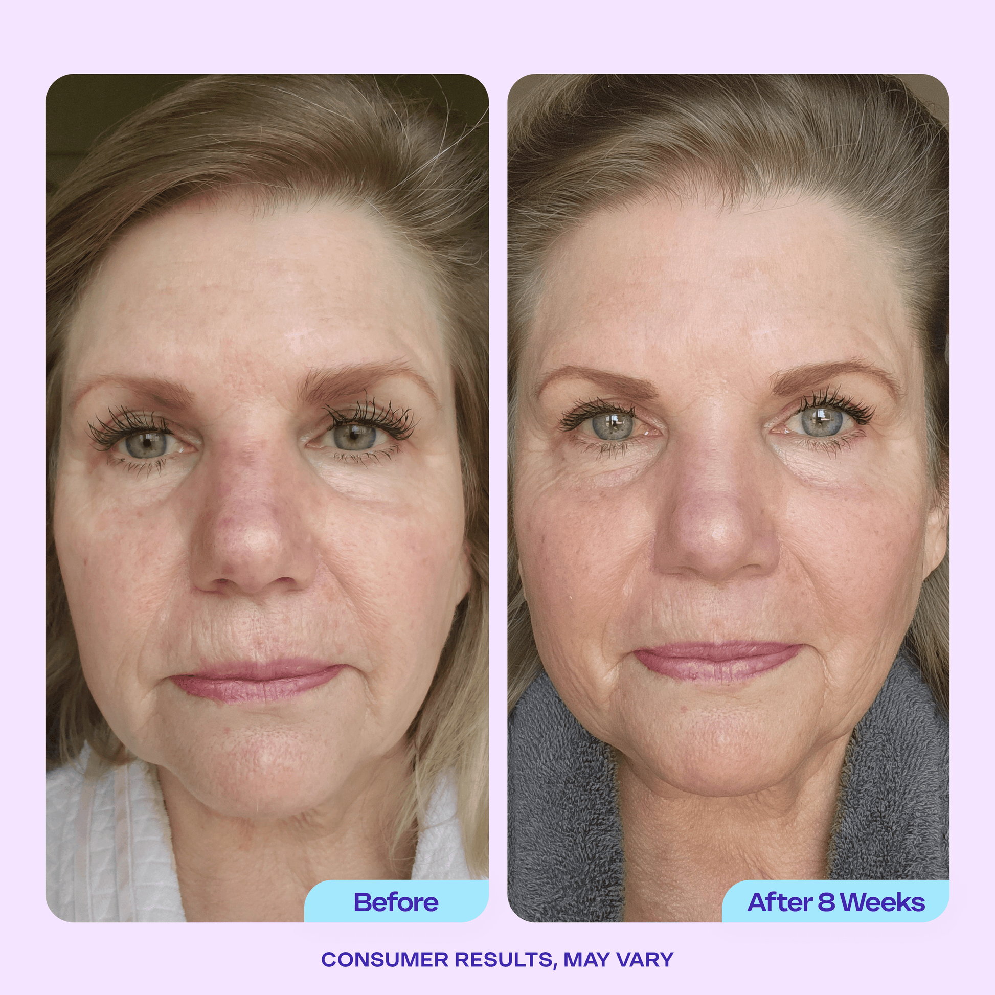 Body & Face Smoothing Set