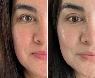 Before and after #1
