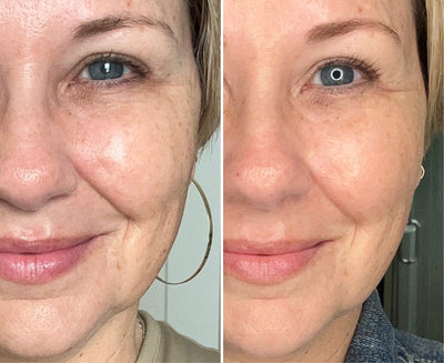 Before and after #3