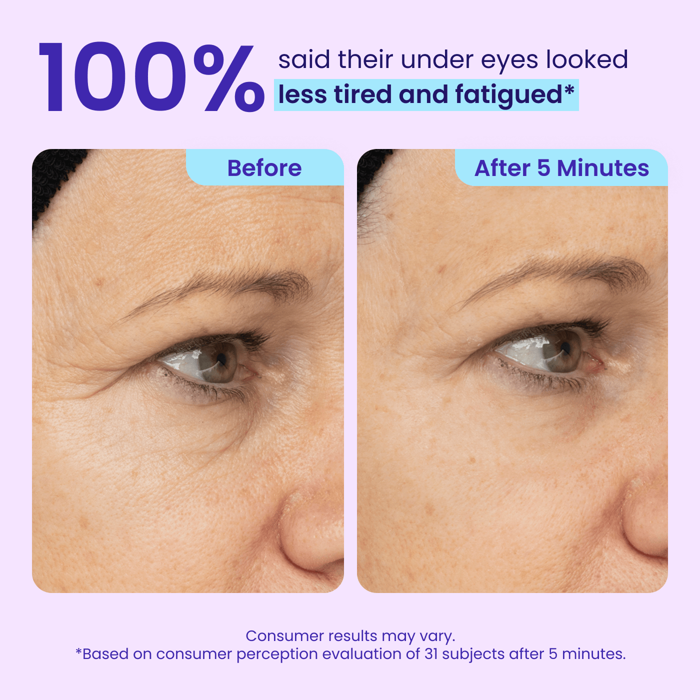 Instant Lift Eye Gel