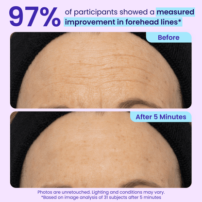 Instant Lift Eye Gel