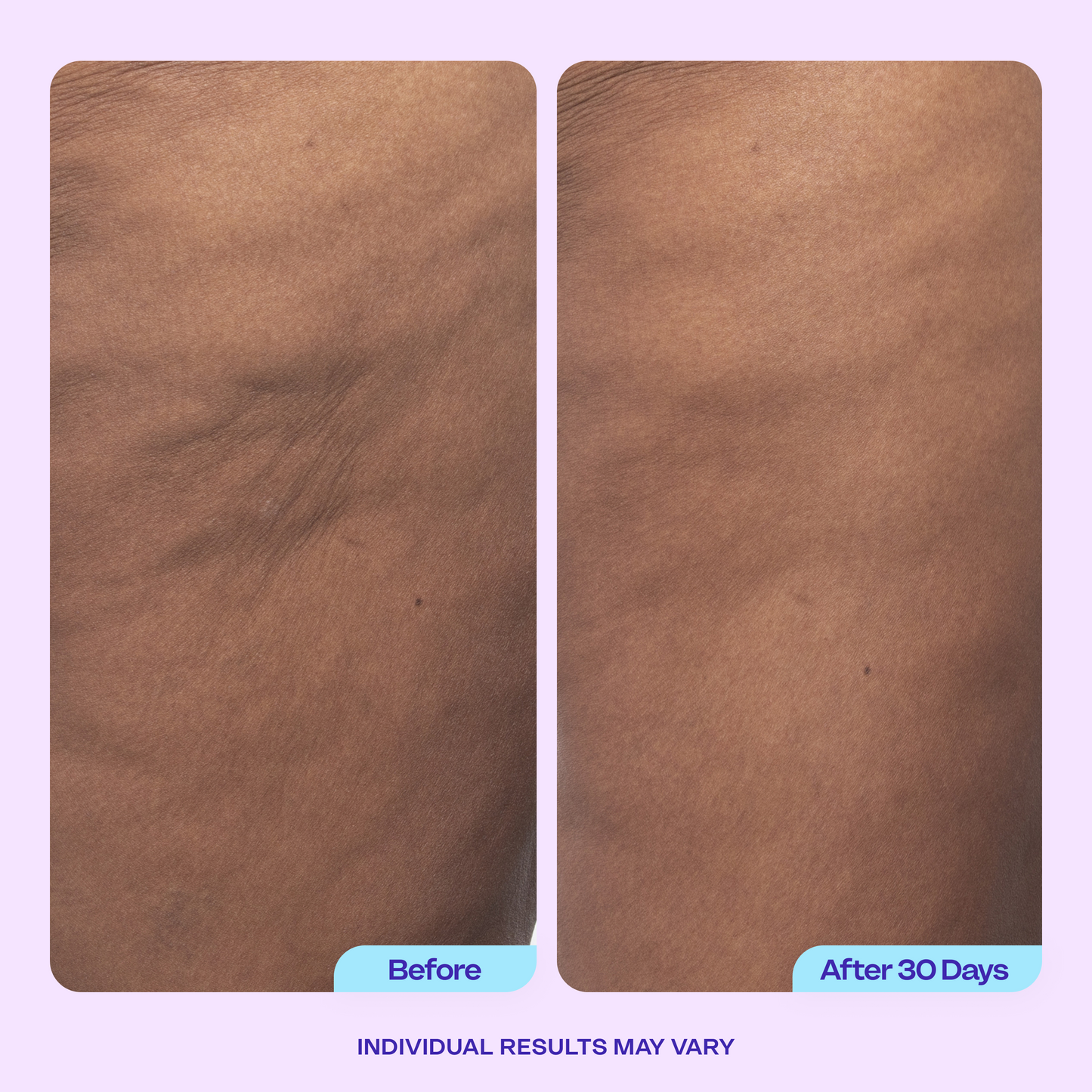 Body Confidence Set