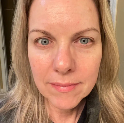 Suzanne K.