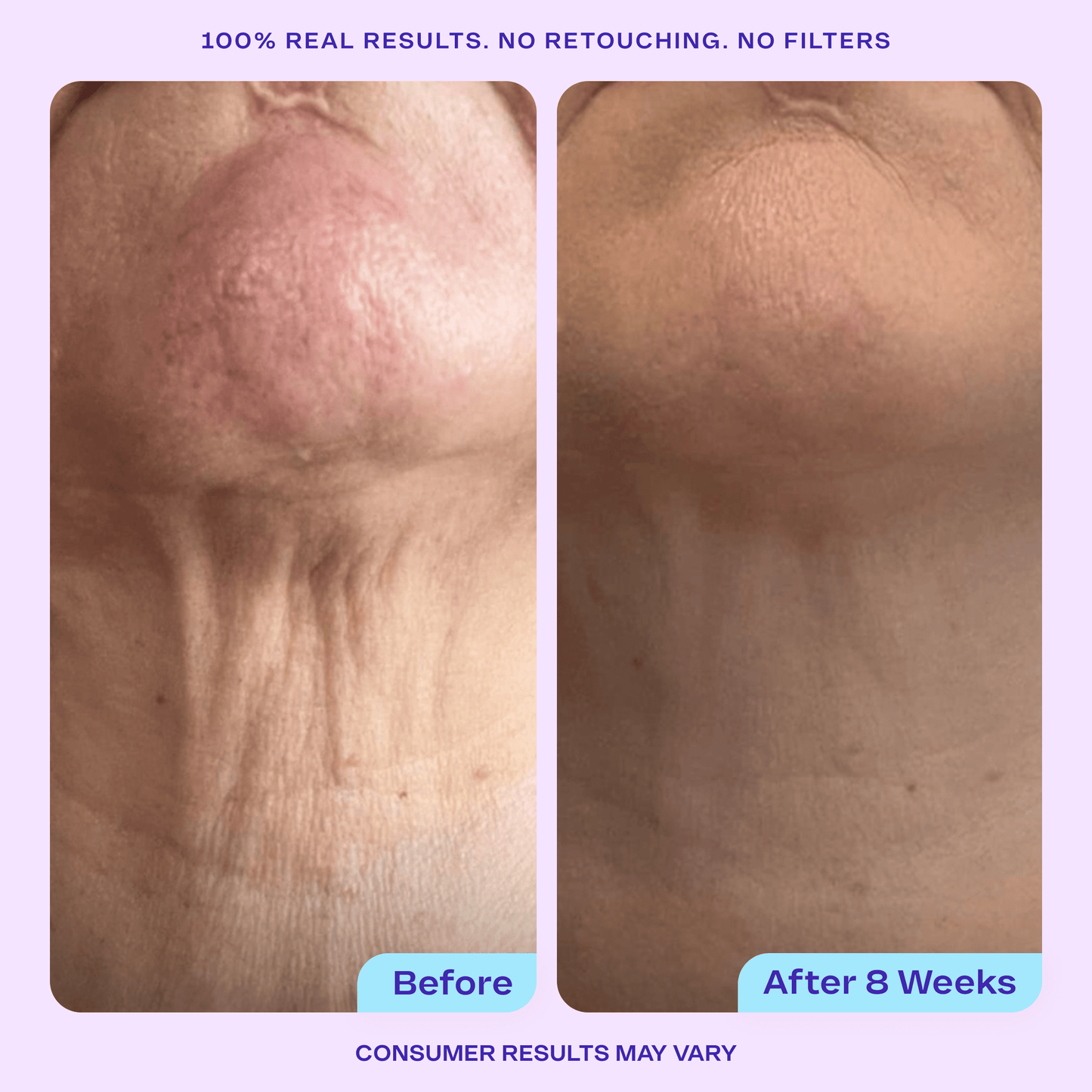 Total Body Firming Set