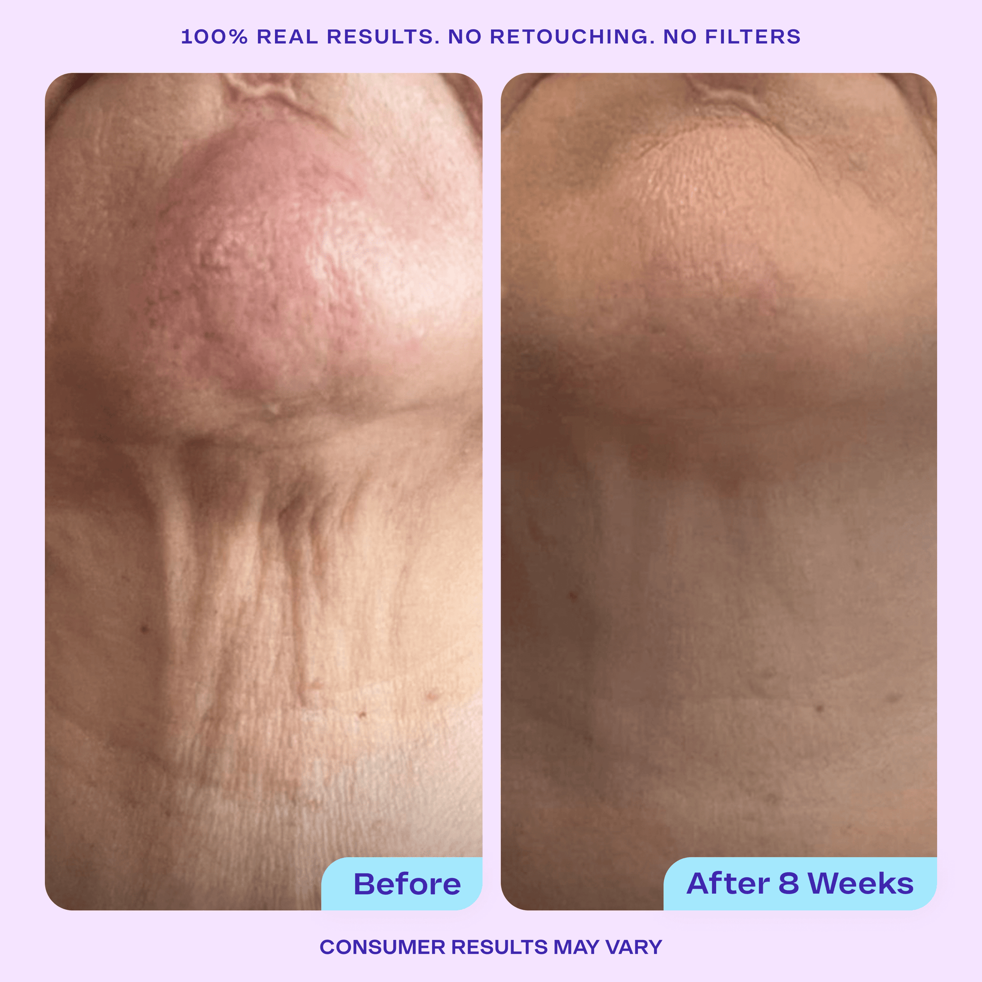 Total Body Firming Set