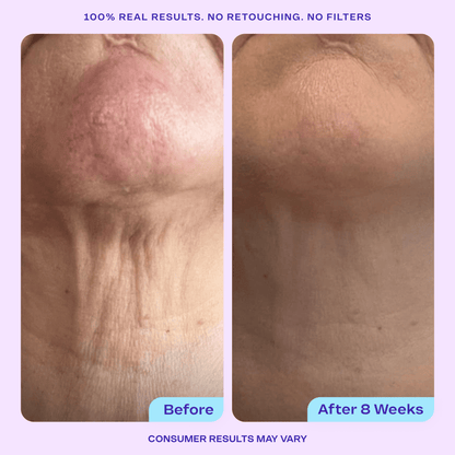 Total Body Firming Set