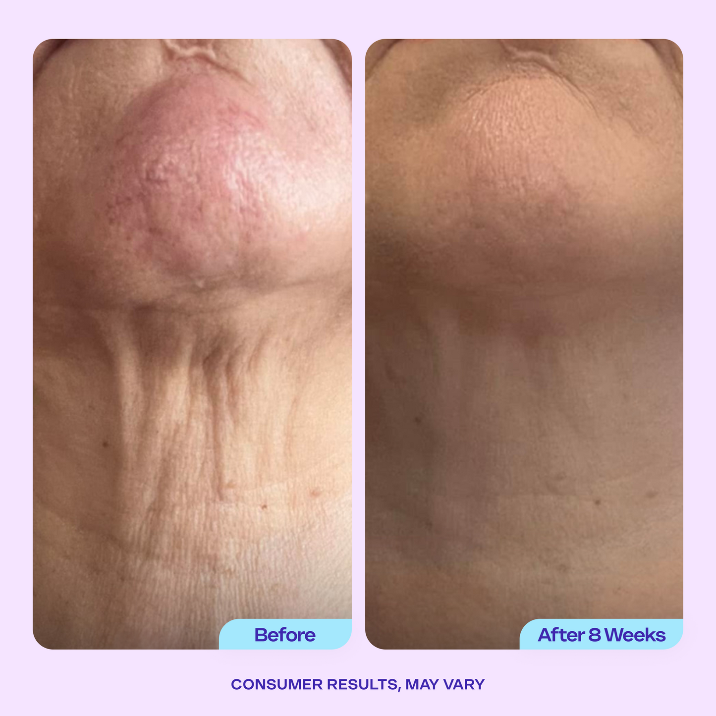 Body Confidence Set