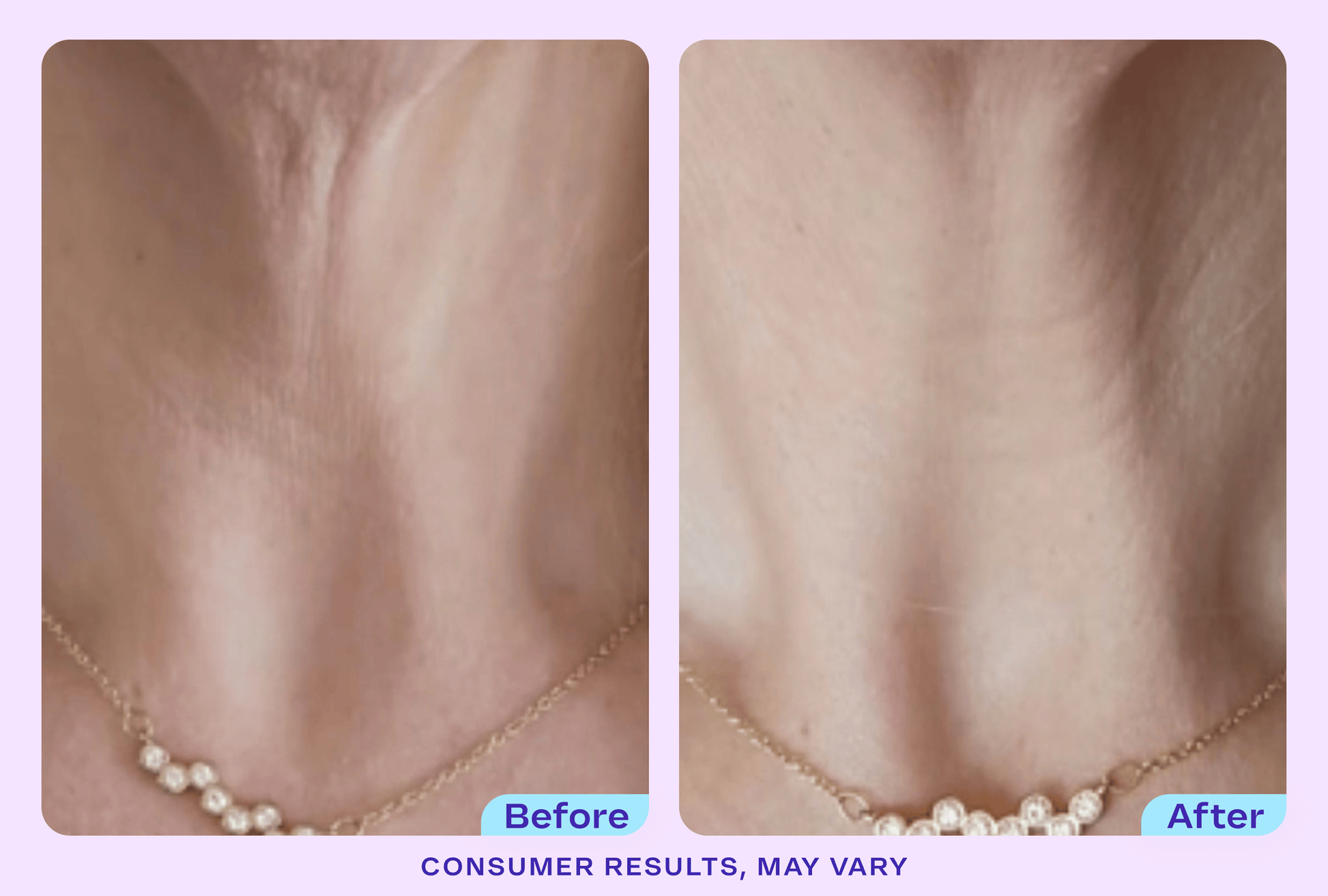 Tighten & Lift Neck Cream - NC41