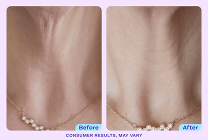 Tighten & Lift Neck Cream - NC41