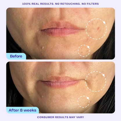 Refine It! BHA Liquid Exfoliant