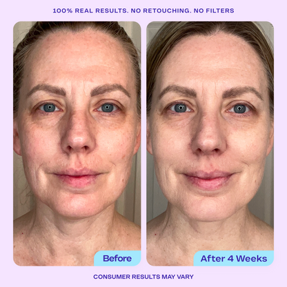 Instant Facial Exfoliation Set