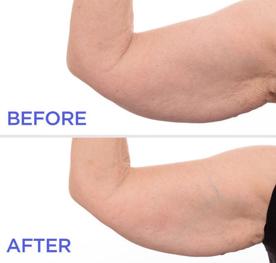 Before and after #3