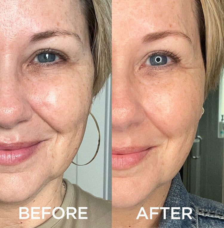 Exclusive Offer: Dramatically Dewy Serum