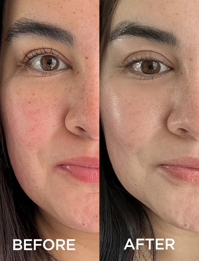Exclusive Offer: Dramatically Dewy Serum