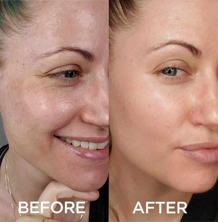 Exclusive Offer: Dramatically Dewy Serum