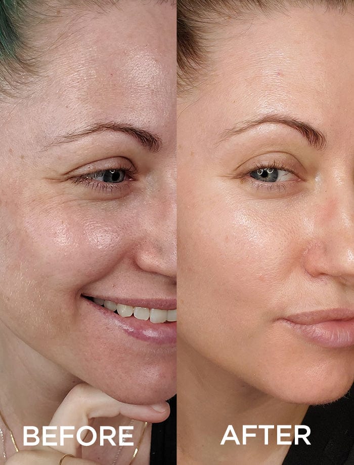 Exclusive Offer: Dramatically Dewy Serum