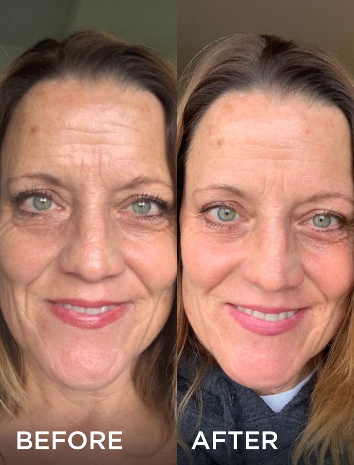 Side-by-side comparison of a woman's face before and after using a skincare product. The "before" image shows wrinkles and uneven skin tone, while the "after" image shows smoother, more even skin.
