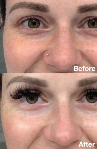 Before & After